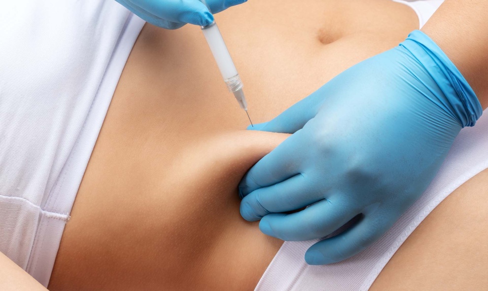 Injection lipolysis